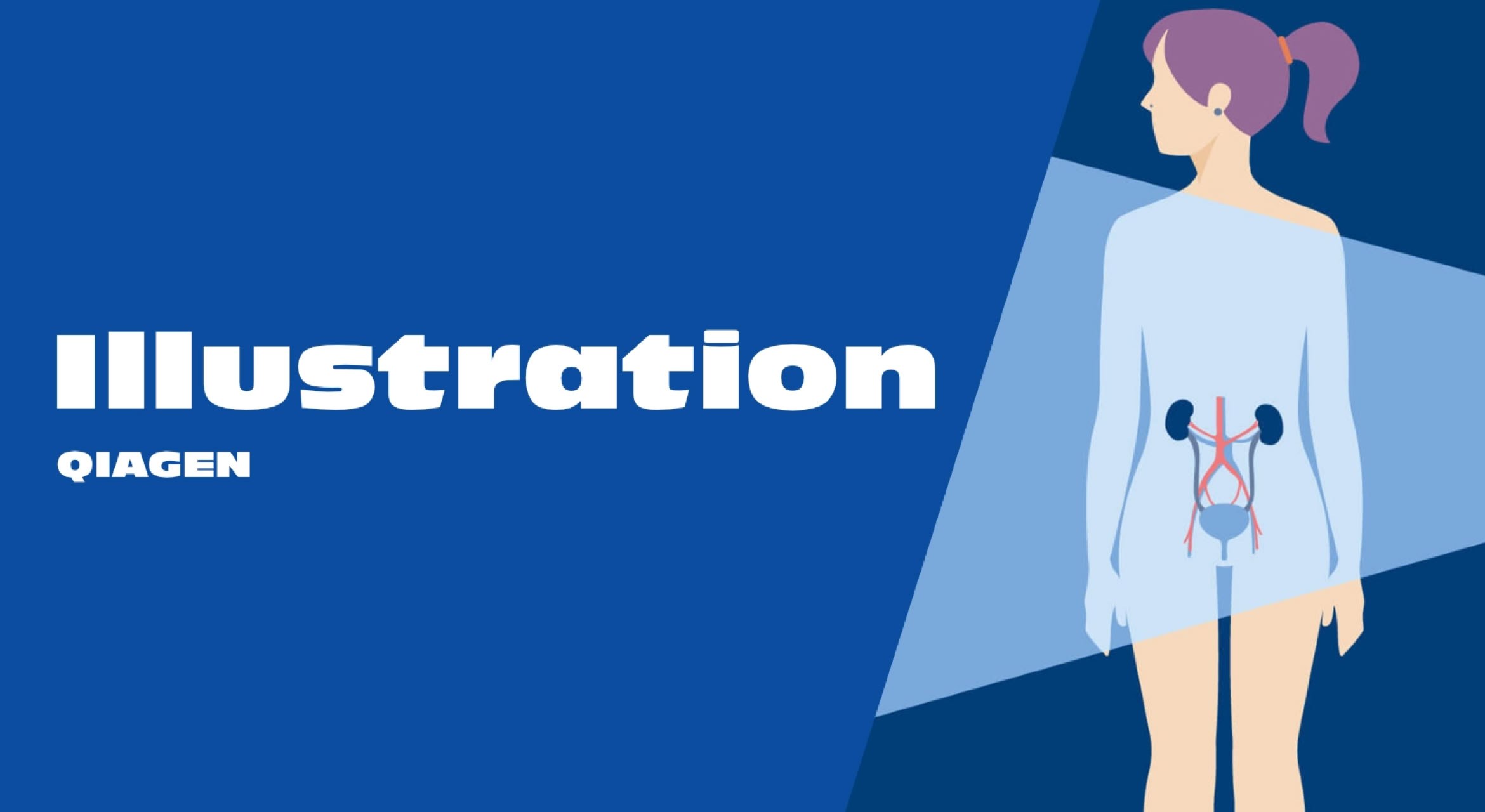 Illustration einer Frau von hinten mit anatomischer Darstellung der Nieren und Harnwege, blauer Hintergrund mit dem Wort "Illustration" und dem Logo "QIAGEN".